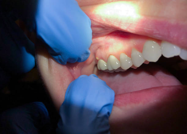  Alexandria, LA Emergency Dentist Pros