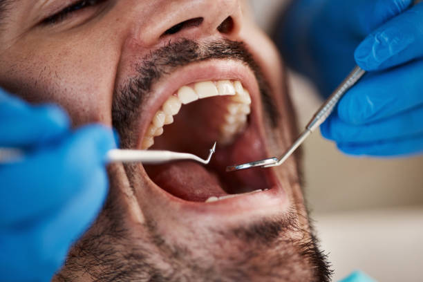 Best Emergency Denture Repair in Alexandria, LA